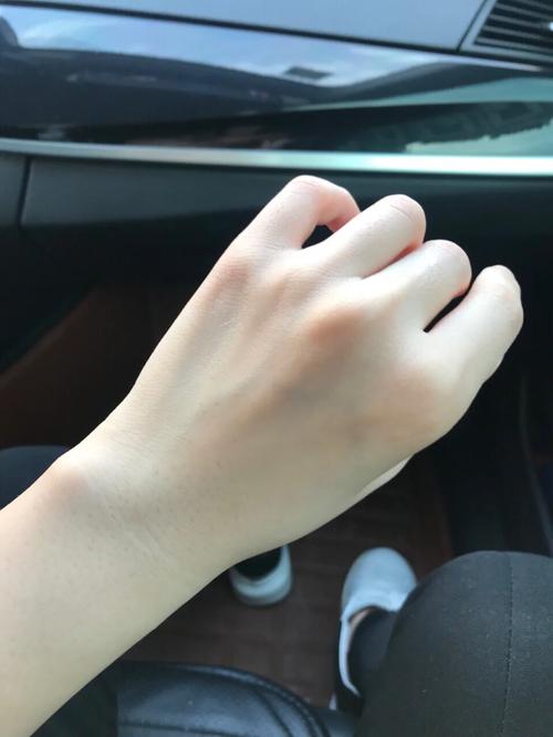 李时珍的皮类似 李时珍的皮类似
